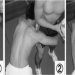 腰痛とラグビー・アメフトの関係