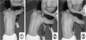 腰痛とラグビー・アメフトの関係