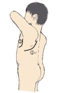 【公式】柏で「肺がん手術後の背中や胸の痛み」専門の整体