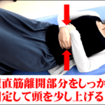 腹直筋離開を治す大事なポイントは?