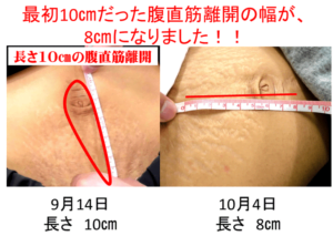 腹直筋離開のトレーニングを紹介！