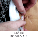 知らなきゃ損する腹直筋離開の改善に必要なこととは？