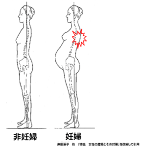 【公式】柏で産前・産後の「背中の痛み」専門の整体