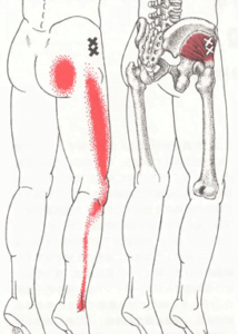 【坐骨神経痛の治し方】坐骨神経の整体は、筋肉をみる！