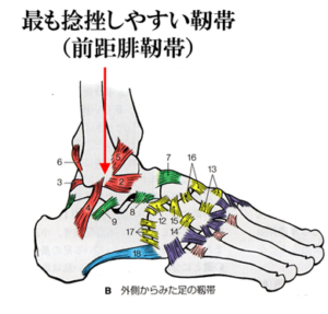 足首の捻挫