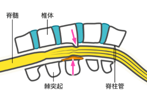 【公式】柏で『腰椎椎間板症』専門の治療・整体