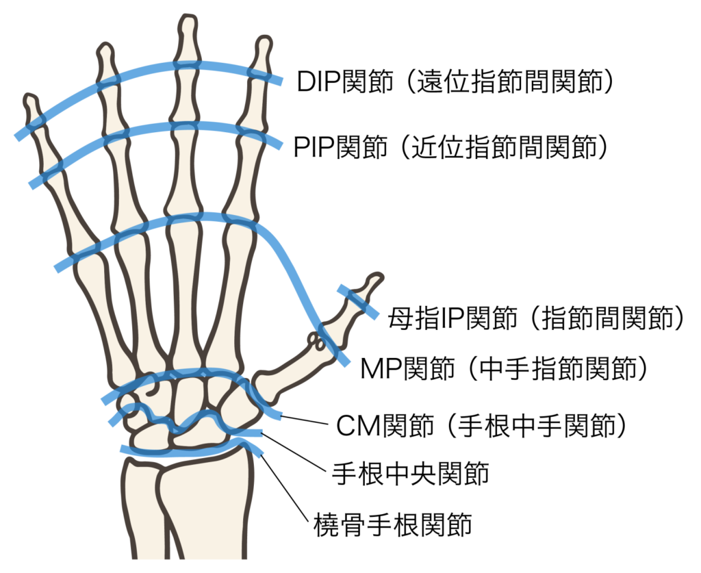 ゴルフ肘（上腕骨内側上顆炎）で治療する関節