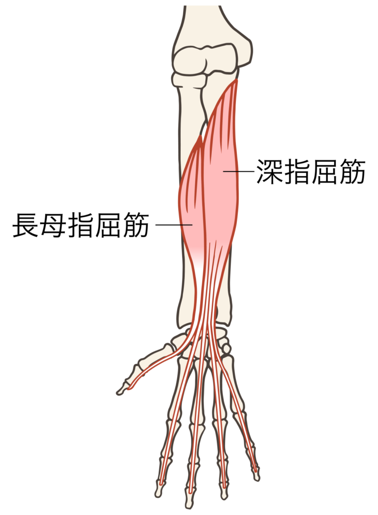 ゴルフ肘（上腕骨内側上顆炎）で治療する筋肉3
