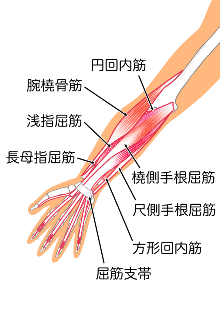 ゴルフ肘（上腕骨内側上顆炎）で治療する筋肉2