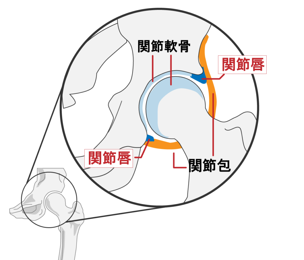 股関節の使いすぎによる鼠径部の痛み