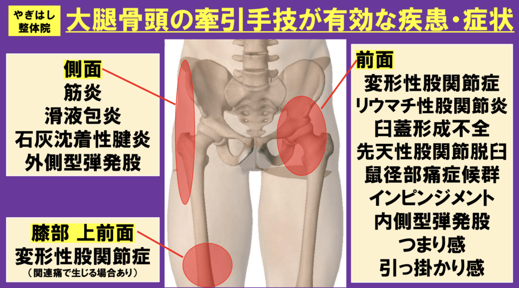 股関節の治療１