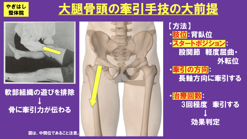 股関節の治療２